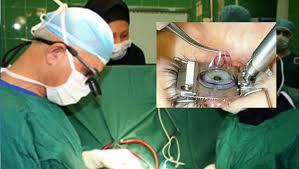 ptergium surgery